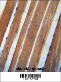 NDUAB Antibody (Center)