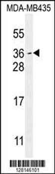 MYCT1 Antibody (C-term)