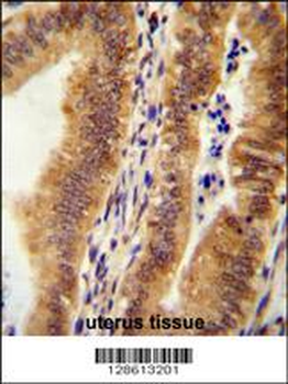 KIAA1609 Antibody (C-term)