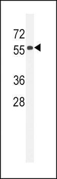 CC85C Antibody (N-term)