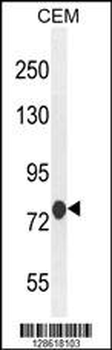 MCAF2 Antibody (Center)