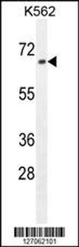 ZN169 Antibody (N-term)