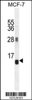 AVPI1 Antibody (N-term)