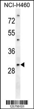 PGAM2 Antibody (N-term)