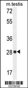 PGAM2 Antibody (N-term)