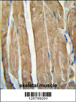 PGAM2 Antibody (N-term)