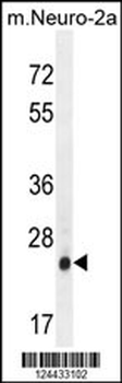 AP3S1 Antibody (N-term)