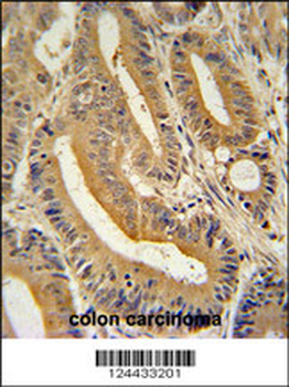 AP3S1 Antibody (N-term)