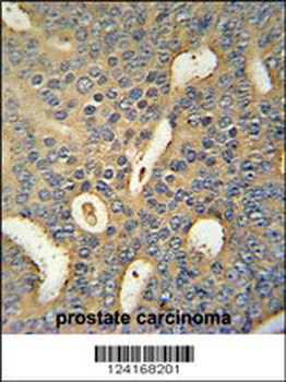 MICALL1 Antibody (C-term)