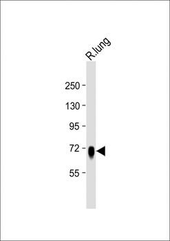 ST7 Antibody (Center)