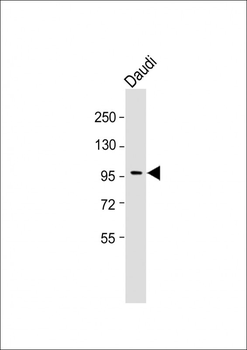 INPP5B Antibody (C-term)