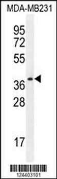 PRSS3 Antibody (N-term)