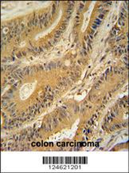 GNAT3 Antibody (Center)