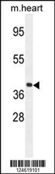 GNA15 Antibody (C-term)