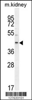 E2F2 Antibody (Center)