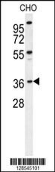 DEM1 Antibody (Center)