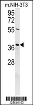 DEM1 Antibody (Center)