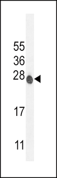 ATP6V0C Antibody (C-term)