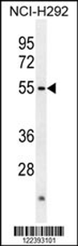 ACTL7A Antibody (N-term)