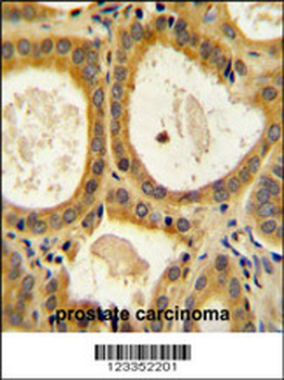 CTLA4 Antibody (N-term)