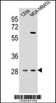 IL12B Antibody (C-term)