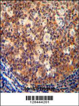 IL12B Antibody (C-term)