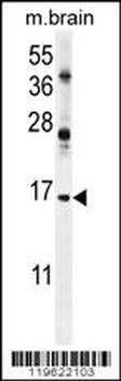 ENSA Antibody (Center)