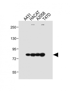 ALOXE3 Antibody (Center)