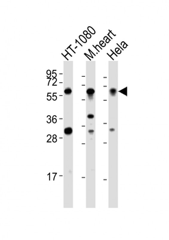SMYD2 Antibody (N-term)