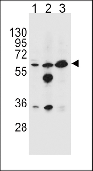 GATM Antibody (N-term)