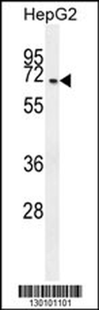 CCDC19 Antibody (N-term)