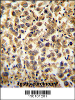 CCDC19 Antibody (N-term)