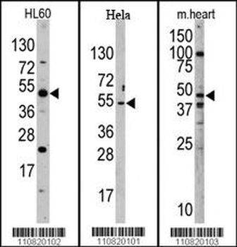 JMJD6 (PTDSR) Antibody (N-term)
