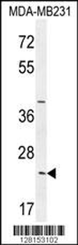 SYCE2 Antibody (N-term)