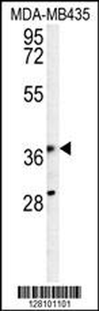 KPRA Antibody (N-term)