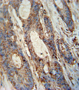 FAM46A Antibody (Center)