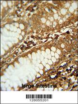 CIART Antibody (N-term)