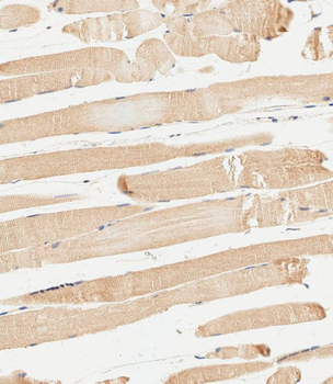 METTL4 Antibody (C-term)
