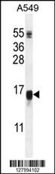 WFDC12 Antibody (C-term)