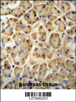 HHIPL2 Antibody (Center)