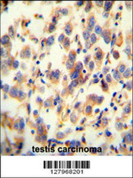 UGT3A2 Antibody (C-term)