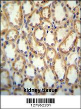 KCNT2 Antibody (C-term)