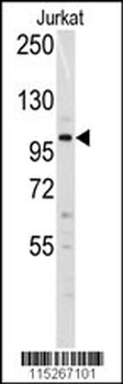 Dnmt3a Antibody (N-term R46)