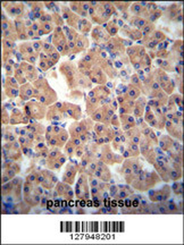 ATPBD3 Antibody (Center)