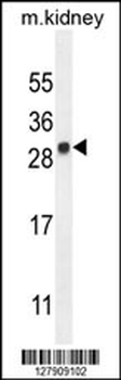 LYPD4 Antibody (Center)