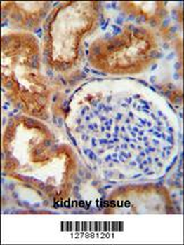 SLC5A12 Antibody (C-term)