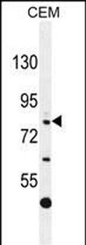 C11orf63 Antibody (C-term)