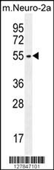 ZDHHC1 Antibody (N-term)