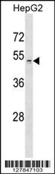 ZDHHC1 Antibody (N-term)