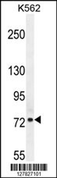 NSUN7 Antibody (C-term)